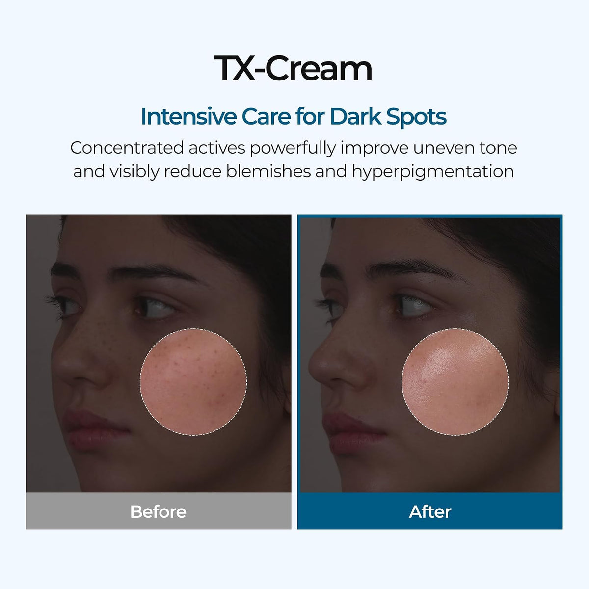 Dark Spot Cream - Tranexamic Acid + Niacinamide Formula For A More Even-Looking Glow