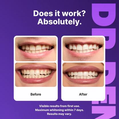 Cancel Yellow Tones Instantly — The Secret To A Brighter, Whiter Smile
