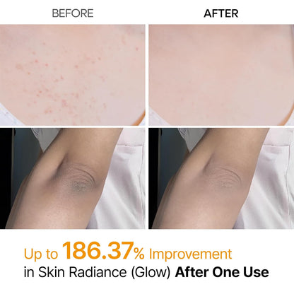 Goodbye "Strawberry Skin," Hello Radiance.