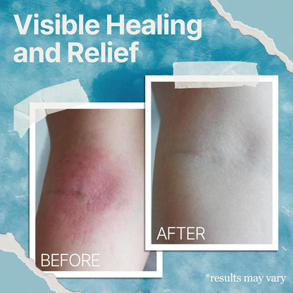 Relieve Irritated Skin with the Healing Power of the Ocean
