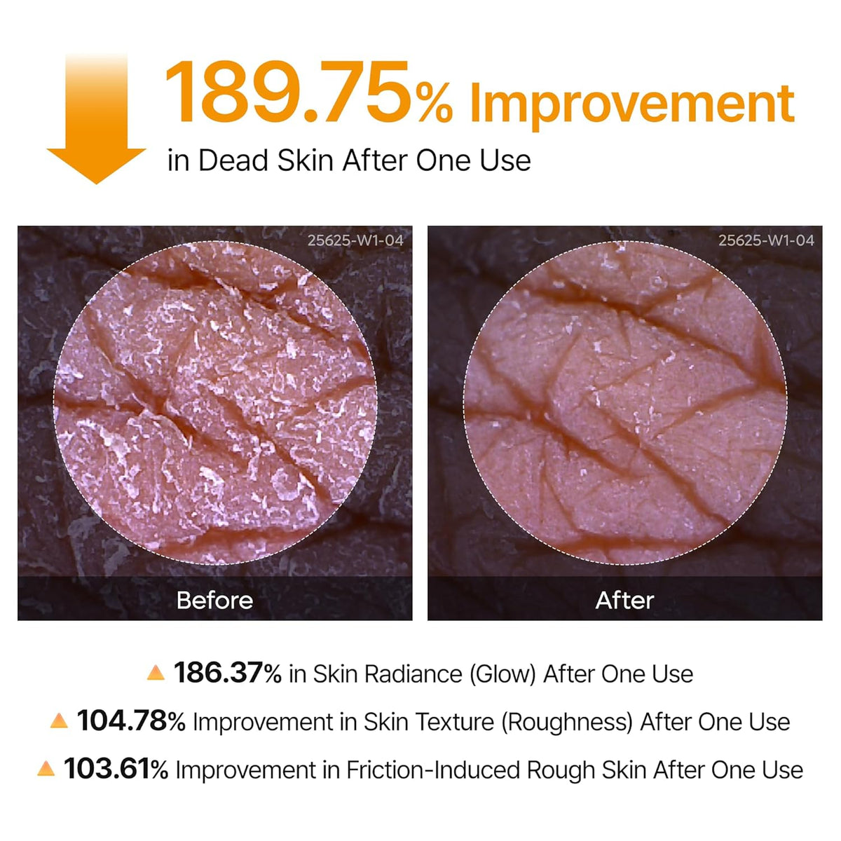 Body Peel Spray - Kojic Acid + Turmeric Formula For Smooth-Looking Skin