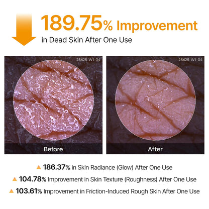 Body Peel Spray - Kojic Acid + Turmeric Formula For Smooth-Looking Skin