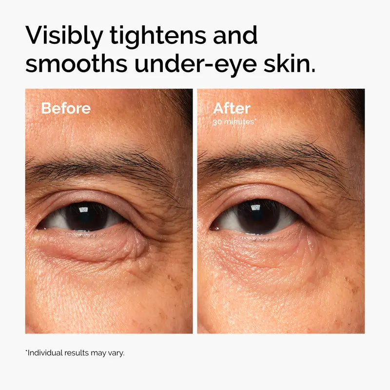 Lacto-PDRN* 4% + B9 Eye Cream | Buy 2 get 1 free