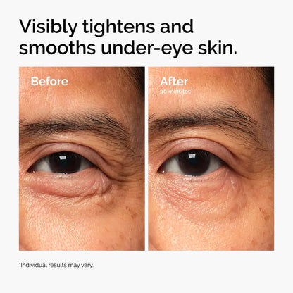 Lacto-PDRN* 4% + B9 Eye Cream | Buy 2 get 1 free