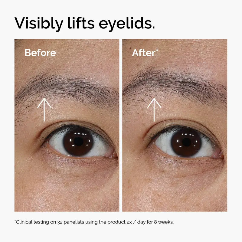 Lacto-PDRN* 4% + B9 Eye Cream | Buy 2 get 1 free